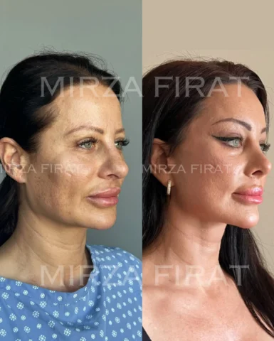 Today I’m sharing the 2-year result of a patient who underwent a comprehensive f