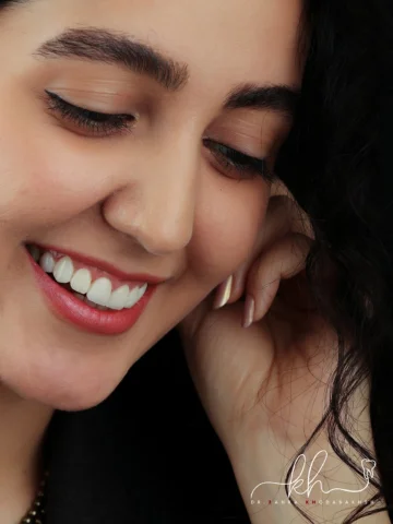 کامپوزیت ونیر لیرینگ✨

درخشش لبخندت همون زیباییه که به چهره‌ت روح بیشتری میده
دس