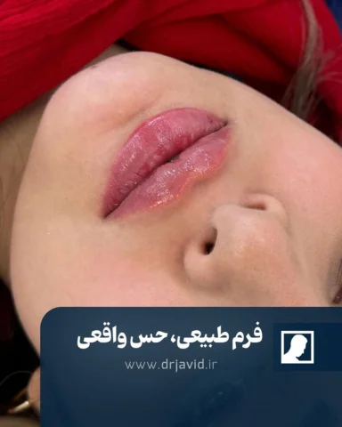⁨	Dr Javid
‌
‌⚜️ زیباترین خودت باش ⚜️
‌
‌🔴 لب‌ها وقتی فرم داشته باشن، لبخند قشن