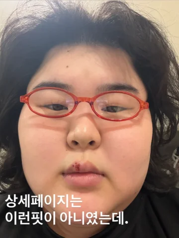 긱시크 너드미 오벌형 뿔테 안경 블루라이트차단 두쫀쿠 마라탕
#관자놀이가 #지끈해요