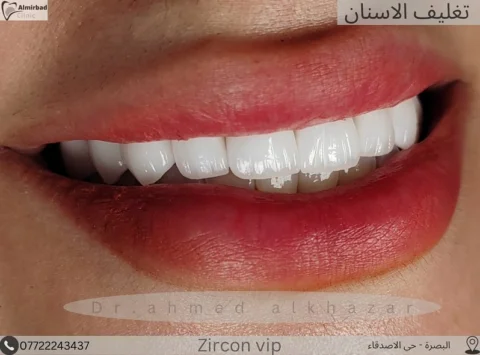 ابتسامة المشاهير 
بتراكيب الزارگون vip 🤍
.
.
.
للحجز والاستفسار زيارة العيادة ل