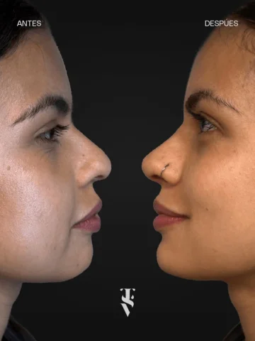 ¿Y SI PUDIERAS CAMBIAR LO QUE TE INCOMODA SIN PASAR POR EL QUIRÓFANO CON EL LOOK