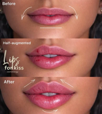 Spring is the perfect time to refresh yourself 💉 Book your appointment today an