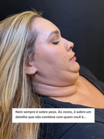 Ela sempre foi magra.
Mas havia algo que não combinava com o restante do rosto: 