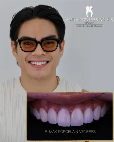 A transformation that doesn’t just change the smile, it elevates the entire aura