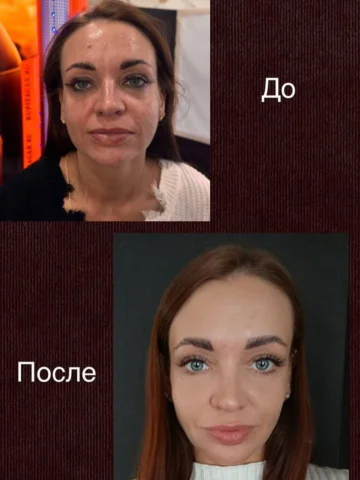 4 день после моей Авторской Техники за одну процедуру

✨Милые кошечки скоро НОВЫ