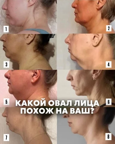 Лимфатическая система

Лимфатическая система решает 80% того, как вы выглядите у