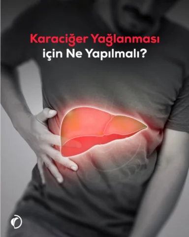 Karaciğer yağlanmasına ne yapılacağını konuşmadan önce, neden oluştuğunu doğru t