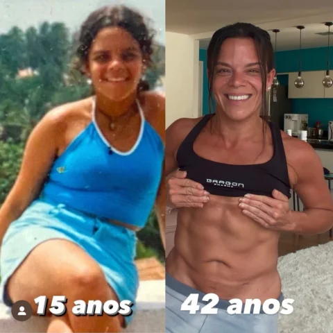 Fui obesa até o começo da adolescência, diagnosticada com endometriose e condrom