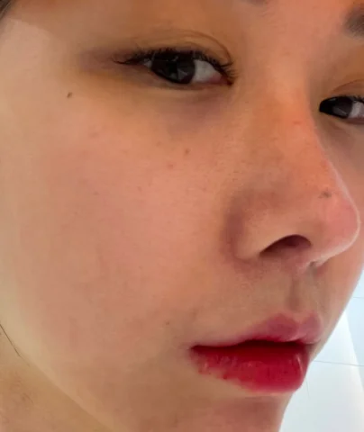 🩸1.2번 100% 일반카메라 입니당🤧

열흘 너무 힘들었어요.....
샷을 너무 넣었나 하고 후회했..........

아니요.
다음엔 더