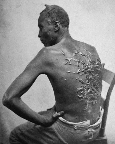Peter (enslaved man), also known as “Whipped Peter,” was an enslaved man who esc