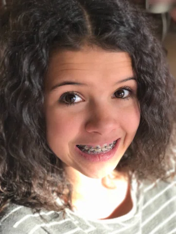It has finally happened…the last kid in the family has braces! Swipe to see who 