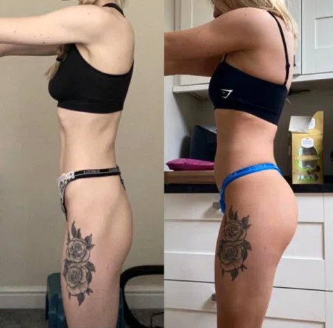 CLIENT SPOTLIGHT-

Your reminder that weight gain can be such a positive thing. 