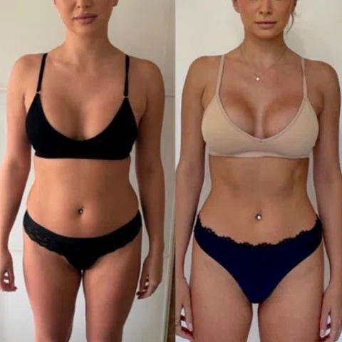8 weeks, 1kg different, a completely different look👏🏻

When this client joined