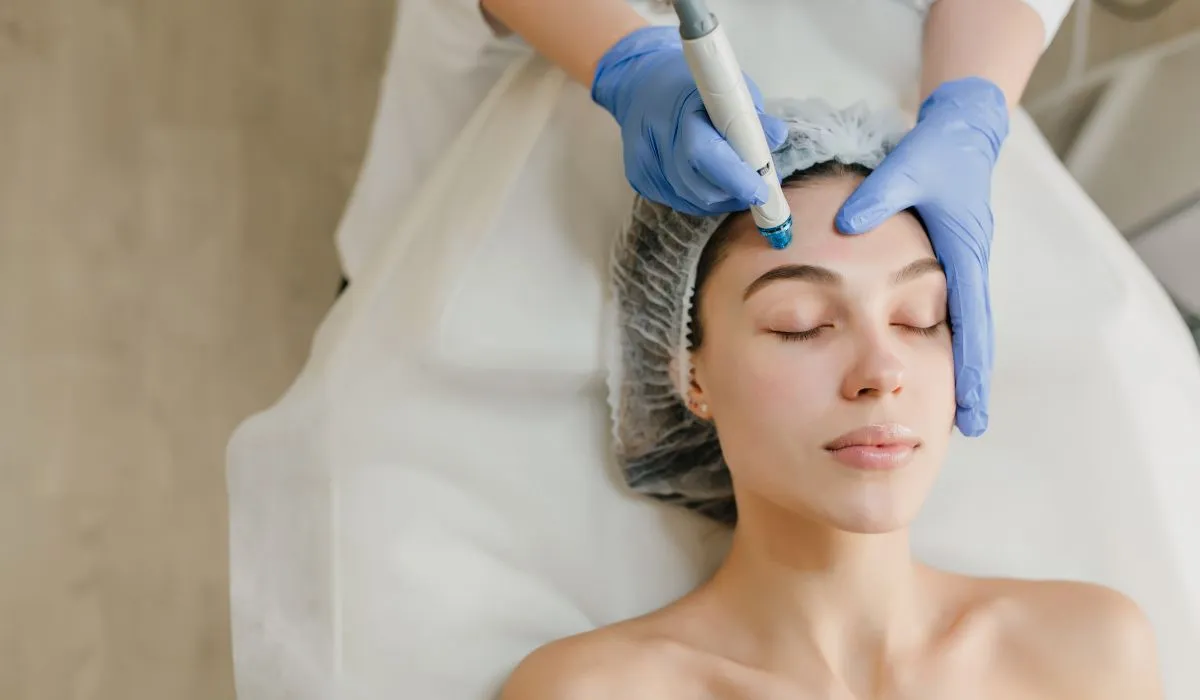 Microneedling boston