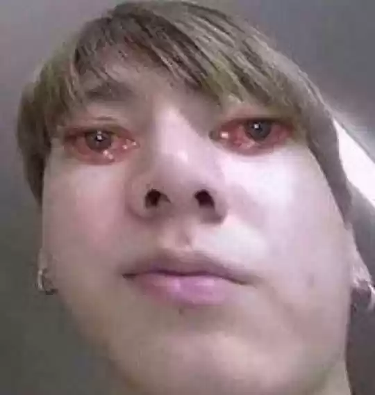 Hold Me Tight Chapter 56