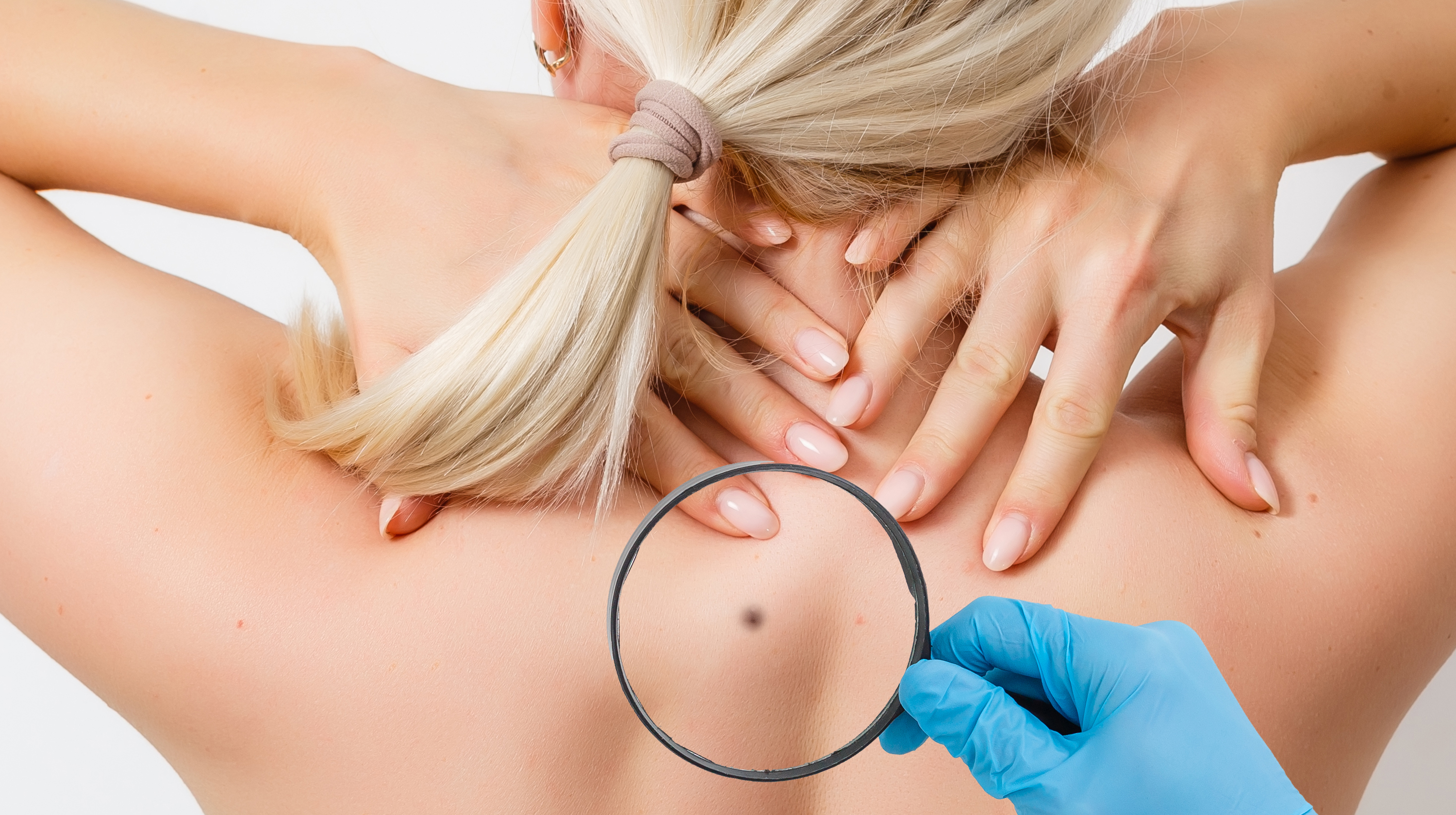 cropped-view-of-dermatologist-examining-skin-of-pa-2023-11-27-04-57-25-utc.jpg