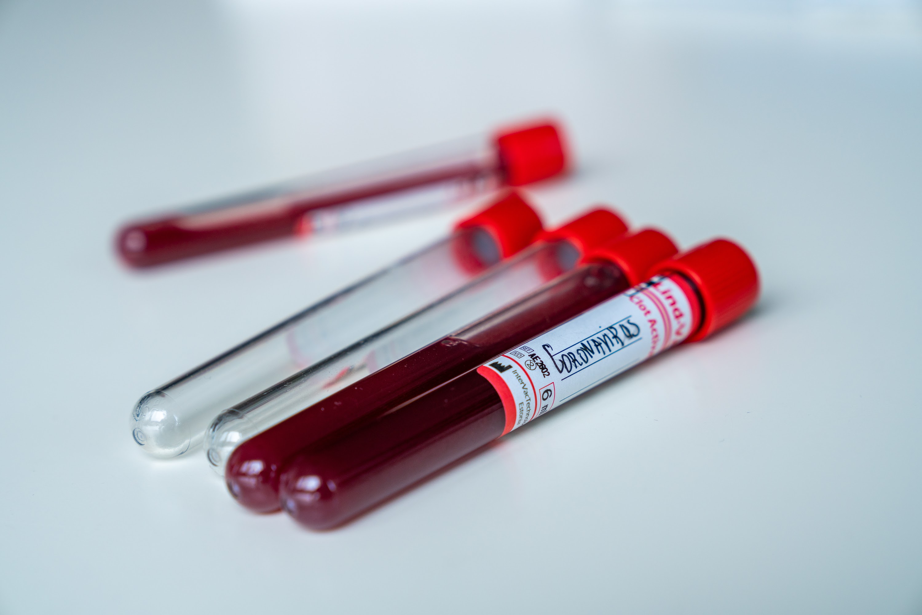 closeup-shot-of-blood-test-tubes-with-red-lids-for-2023-11-27-05-08-37-utc.jpeg