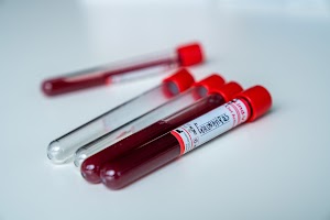 closeup-shot-of-blood-test-tubes-with-red-lids-for-2023-11-27-05-08-37-utc.jpeg