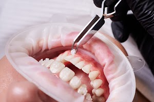 dentist-attaching-orthodontic-brackets-to-patient-2023-11-27-05-16-32-utc.jpg