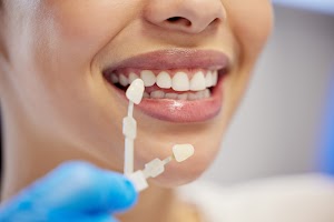 shot-of-an-unrecognisable-woman-having-her-teeth-c-2023-11-27-05-17-20-utc.jpg