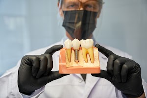 serious-dentist-showing-a-teeth-model-with-implant-2023-11-27-05-25-19-utc.jpg