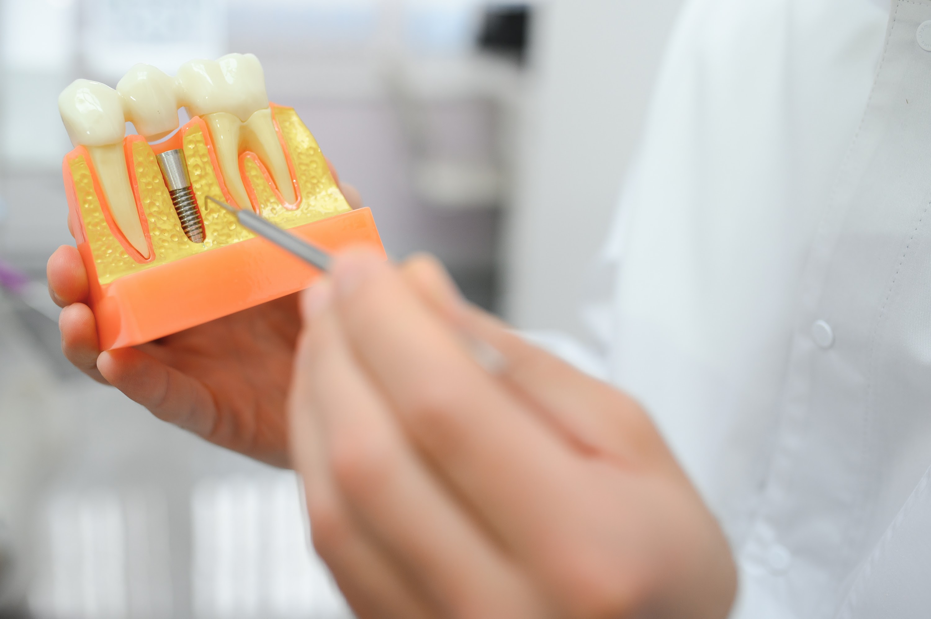 doctor-shows-on-a-plastic-tooth-sample-or-model-di-2023-11-27-05-27-03-utc.jpg