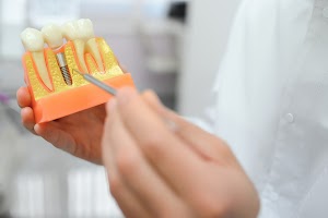doctor-shows-on-a-plastic-tooth-sample-or-model-di-2023-11-27-05-27-03-utc.jpg