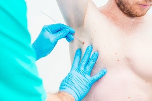 doctor-dermatologist-hands-in-gloves-examine-under-2025-02-13-23-03-37-utc.jpg
