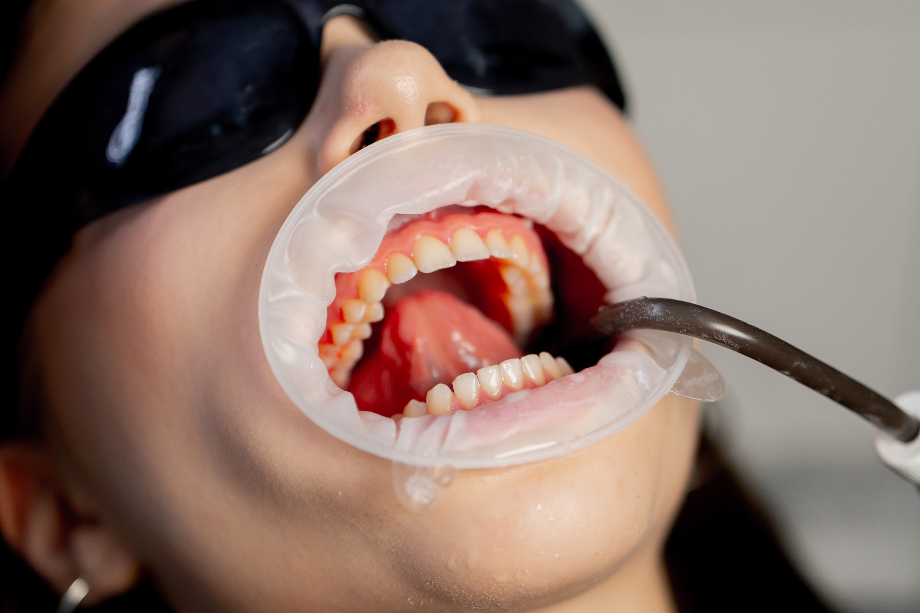 close-up-in-the-dental-office-of-young-beautiful-g-2024-11-27-11-22-30-utc.jpg