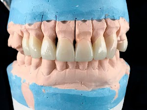 dental-porcelain-prosthesis-implant-tooth-in-denta-2025-02-03-11-45-08-utc.jpeg
