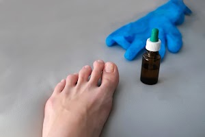close-up-of-foot-with-nail-fungus-medical-glove-an-2025-01-07-23-24-35-utc.jpg