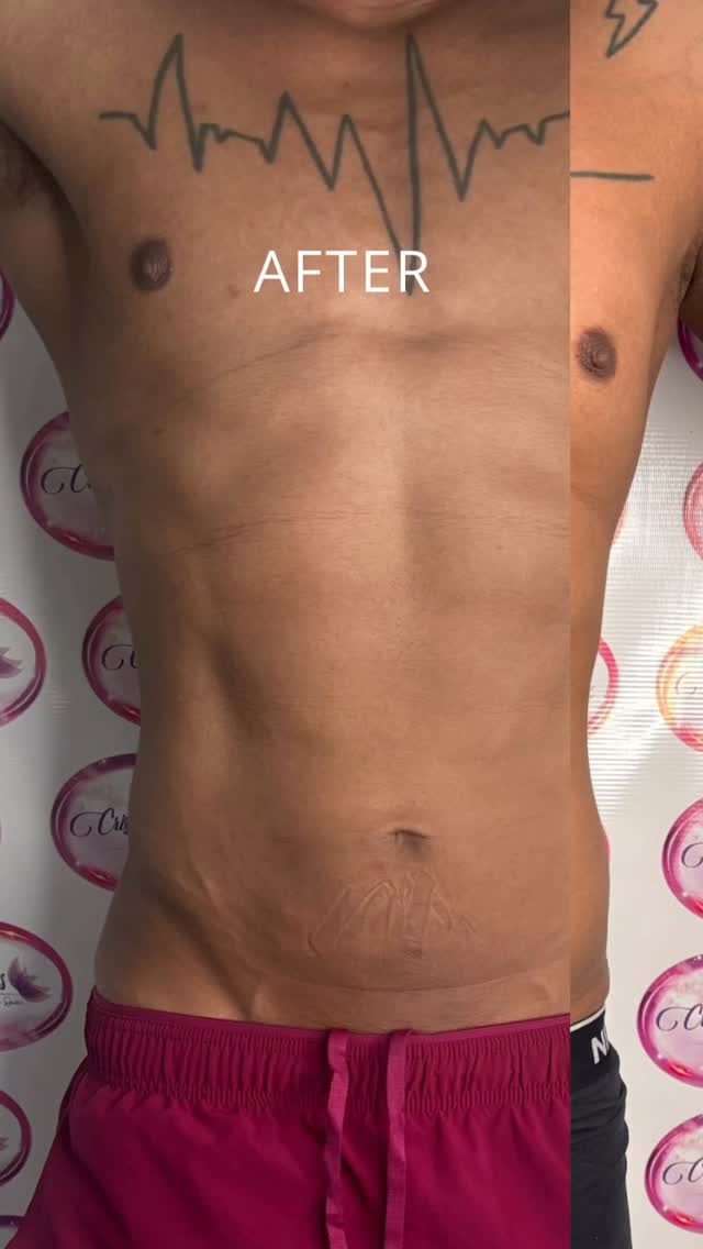 Cristina's Beauty Spa Instagram: Los resultados no dependen de una sola sesión… dependen del compromiso completo. ✨

El 50% lo ponemo…