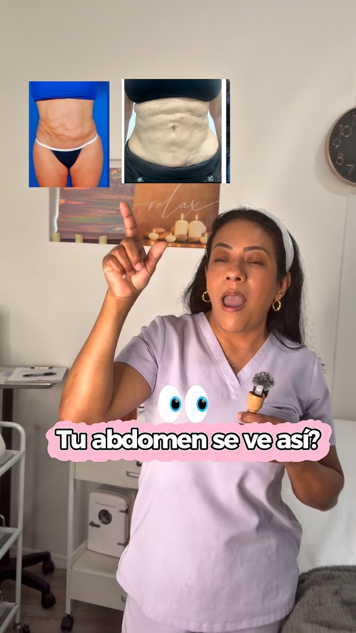 Cristina's Beauty Spa Instagram: ⚠️ ¿Después de tu cirugía notas zonas duras, bultos o irregularidades en tu abdomen?

Podrías estar…