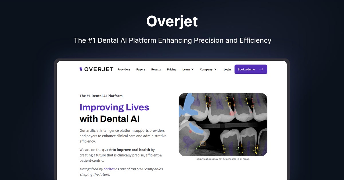 Overjet