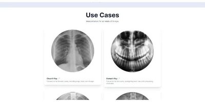 X-ray Interpreter